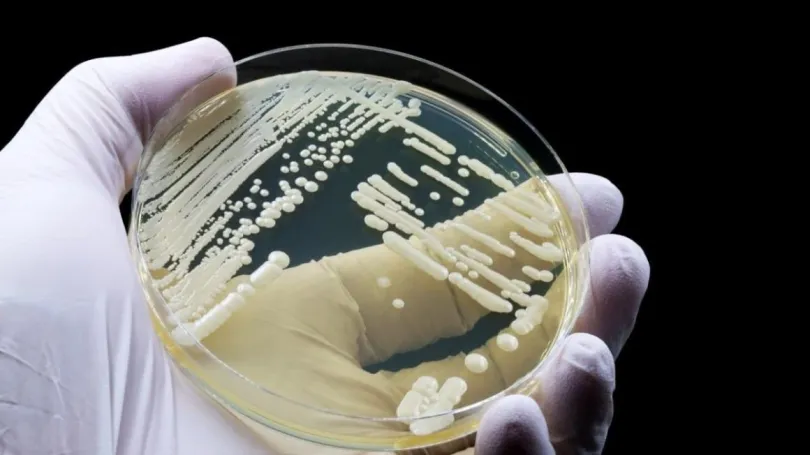 Google: Hong Kong Hospital Authority leveraging AI to combat superbug infections